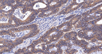 beta Catenin Antibody in Immunohistochemistry (Paraffin) (IHC (P))