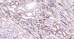 beta Catenin Antibody in Immunohistochemistry (Paraffin) (IHC (P))