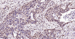 Phospho-p38 MAPK alpha (Thr180, Tyr182) Recombinant Rabbit Monoclonal Antibody (SB98)