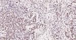 Phospho-p38 MAPK alpha (Thr180, Tyr182) Antibody in Immunohistochemistry (Paraffin) (IHC (P))