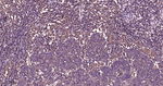 p38 MAPK alpha Antibody in Immunohistochemistry (Paraffin) (IHC (P))