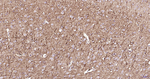 NF-L Antibody in Immunohistochemistry (Paraffin) (IHC (P))