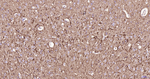 NF-L Antibody in Immunohistochemistry (Paraffin) (IHC (P))