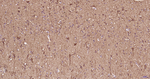 NF-L Antibody in Immunohistochemistry (Paraffin) (IHC (P))