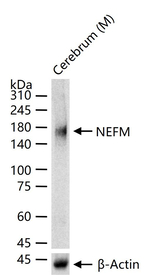 NF-L Antibody in Western Blot (WB)