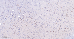 TGM2 Antibody in Immunohistochemistry (Paraffin) (IHC (P))
