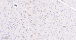 TGM2 Antibody in Immunohistochemistry (Paraffin) (IHC (P))