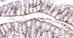 TGM2 Antibody in Immunohistochemistry (Paraffin) (IHC (P))
