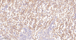 TGM2 Antibody in Immunohistochemistry (Paraffin) (IHC (P))