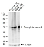 TGM2 Antibody in Western Blot (WB)