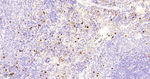 Myeloperoxidase Antibody in Immunohistochemistry (Paraffin) (IHC (P))