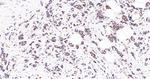 PMS2 Antibody in Immunohistochemistry (Paraffin) (IHC (P))