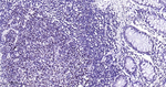 PMS2 Recombinant Rabbit Monoclonal Antibody (5F9)