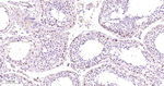 PMS2 Antibody in Immunohistochemistry (Paraffin) (IHC (P))