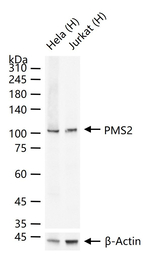 PMS2 Antibody in Western Blot (WB)