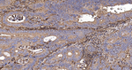 uPAR Antibody in Immunohistochemistry (Paraffin) (IHC (P))
