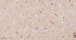 uPAR Antibody in Immunohistochemistry (Paraffin) (IHC (P))
