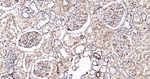 uPAR Antibody in Immunohistochemistry (Paraffin) (IHC (P))