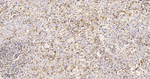 uPAR Antibody in Immunohistochemistry (Paraffin) (IHC (P))