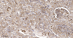 uPAR Recombinant Rabbit Monoclonal Antibody (7D9)