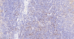 CD86 Recombinant Rabbit Monoclonal Antibody (5C9)