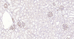 VEGF Antibody in Immunohistochemistry (Paraffin) (IHC (P))
