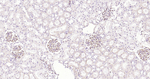 VEGF Antibody in Immunohistochemistry (Paraffin) (IHC (P))