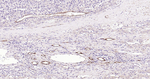 VEGF Recombinant Rabbit Monoclonal Antibody (4G7)