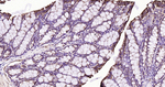 IkB alpha Antibody in Immunohistochemistry (Paraffin) (IHC (P))