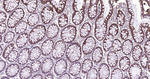 IkB alpha Antibody in Immunohistochemistry (Paraffin) (IHC (P))