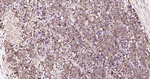 IkB alpha Recombinant Rabbit Monoclonal Antibody (13D1)
