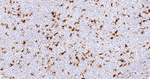 IL-18 Antibody in Immunohistochemistry (Paraffin) (IHC (P))