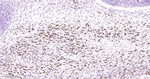 Myogenin Antibody in Immunohistochemistry (Paraffin) (IHC (P))
