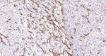 Collagen IV Antibody in Immunohistochemistry (Paraffin) (IHC (P))