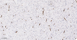 Collagen IV Antibody in Immunohistochemistry (Paraffin) (IHC (P))