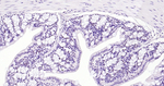 EZH2 Antibody in Immunohistochemistry (Paraffin) (IHC (P))
