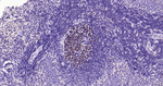 EZH2 Antibody in Immunohistochemistry (Paraffin) (IHC (P))