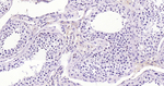EZH2 Antibody in Immunohistochemistry (Paraffin) (IHC (P))