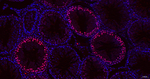 EZH2 Antibody in Immunohistochemistry (Paraffin) (IHC (P))