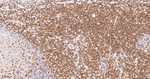 CD3 Antibody in Immunohistochemistry (Paraffin) (IHC (P))