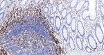 CD3 Antibody in Immunohistochemistry (Paraffin) (IHC (P))