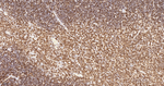 CD3 Antibody in Immunohistochemistry (Paraffin) (IHC (P))