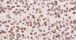 EIF2S1 Antibody in Immunohistochemistry (Paraffin) (IHC (P))