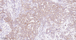 EIF2S1 Antibody in Immunohistochemistry (Paraffin) (IHC (P))