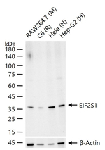 EIF2S1 Antibody in Western Blot (WB)