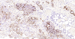 Mesothelin Antibody in Immunohistochemistry (Paraffin) (IHC (P))