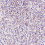 Mesothelin Antibody in Immunohistochemistry (Paraffin) (IHC (P))