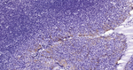 Mesothelin Antibody in Immunohistochemistry (Paraffin) (IHC (P))