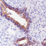 Mesothelin Antibody in Immunohistochemistry (Paraffin) (IHC (P))