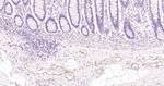 P-Selectin Antibody in Immunohistochemistry (Paraffin) (IHC (P))